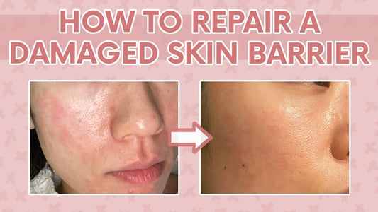 Barrier Repair 101: Why Your Skin Barrier Matters (and How to Fix It)