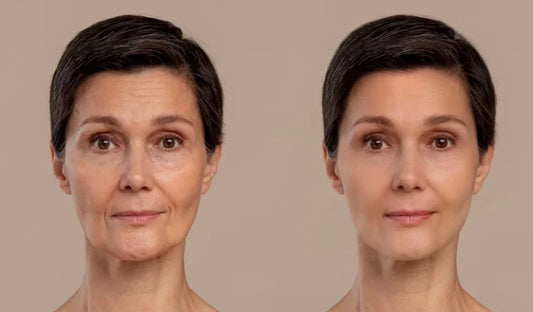 Anti-Aging Skincare: When and How to Start.